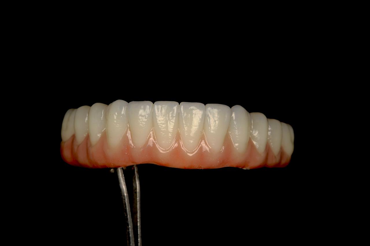 Cerâmica